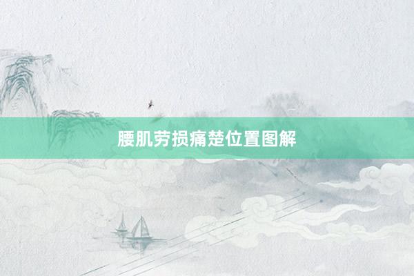 腰肌劳损痛楚位置图解